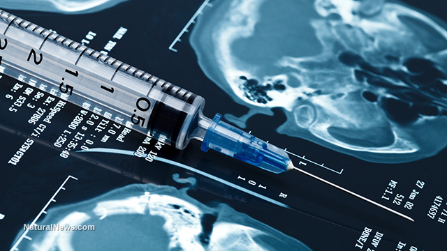 Vakcíny mRNA môžu spôsobiť, že vaše telo začne „jesť váš mozog“
